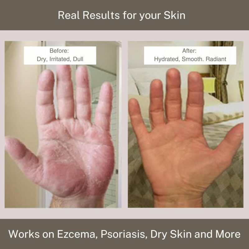 Should You Buy InfiniteAloe Complete Skin Care?